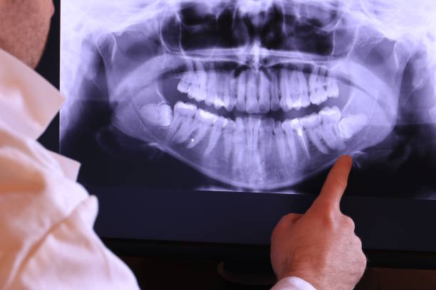Best Emergency Cosmetic Dentistry in Hickory, NC