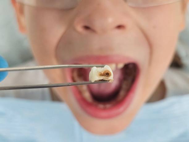 Best Emergency Dental Services for Seniors in Hickory, NC